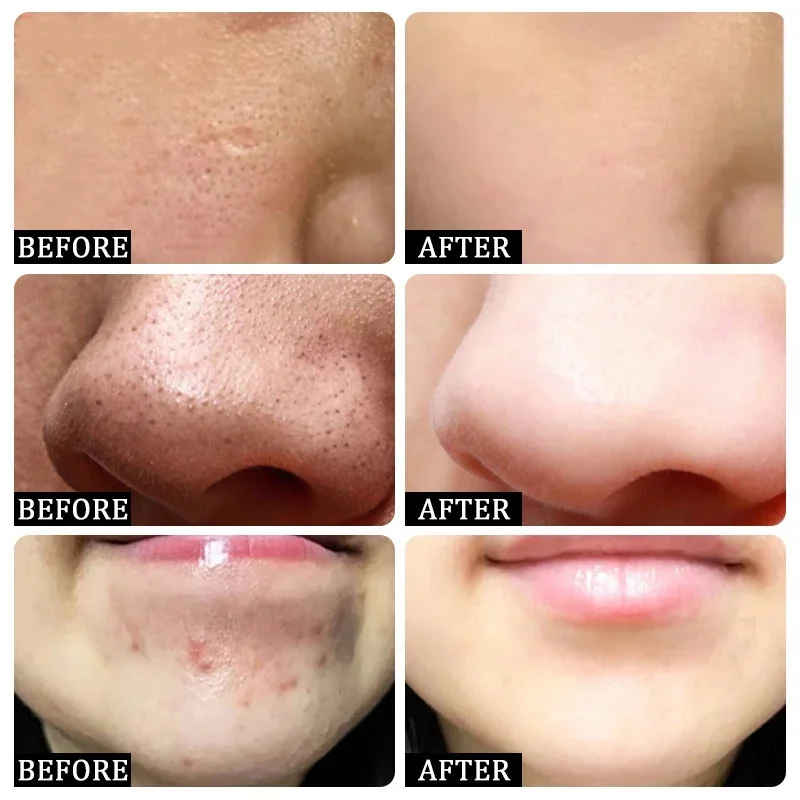 Salicylic Acid Pore Clearing C - đánh giá và giá Korean Skincare Routine