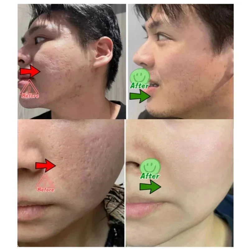 Salicylic Acid Pore Clearing C - đánh giá và giá Korean Skincare Routine