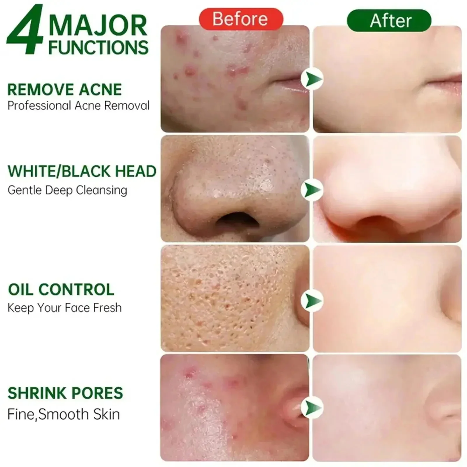 Salicylic Acid Pore Clearing C - đánh giá và giá Korean Skincare Routine