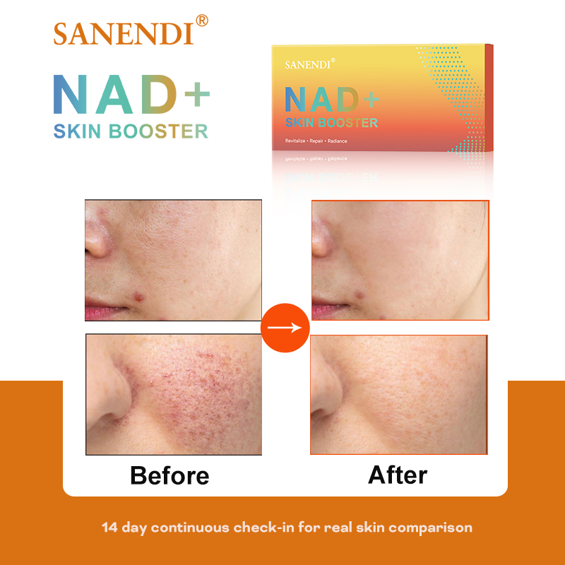 Sanendi NAD+ Korea Skincare Pr - đánh giá và giá Korean Skincare Routine